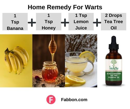 1_Home_Remedies_For_Warts