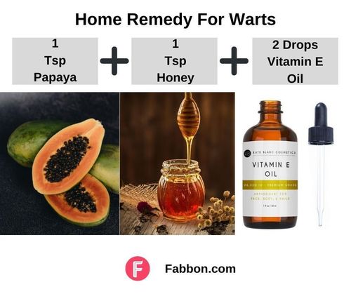 2_Home_Remedies_For_Warts