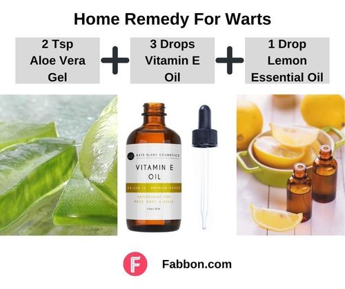 4_Home_Remedies_For_Warts