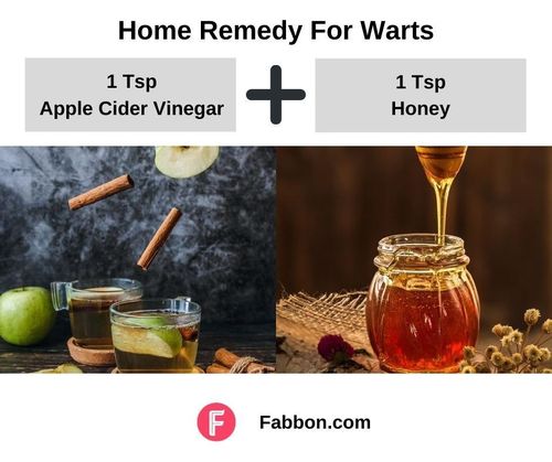 6_Home_Remedies_For_Warts