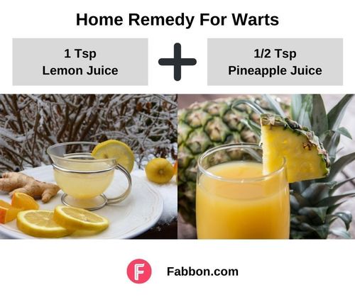 7_Home_Remedies_For_Warts