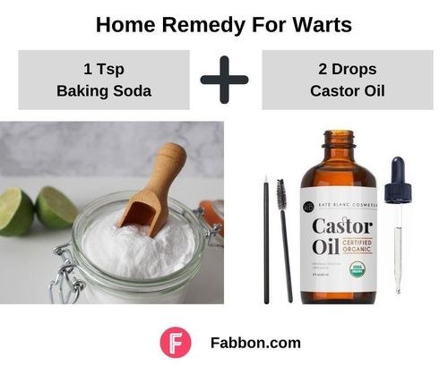 8_Home_Remedies_For_Warts