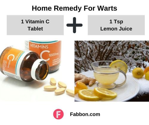 9_Home_Remedies_For_Warts