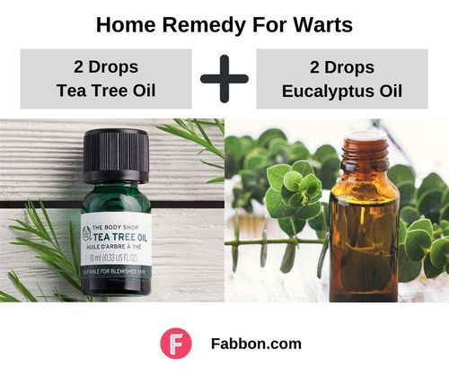 11_Home_Remedies_For_Warts