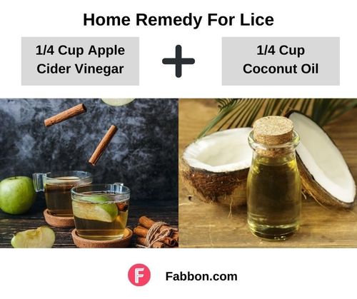 6_Home_Remedies_For_Lice