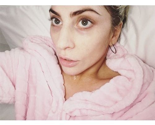 23_Lady_Gaga_No_Makeup