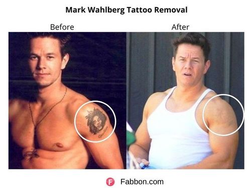 Celebrities Whove Had Their Tattoos Removed