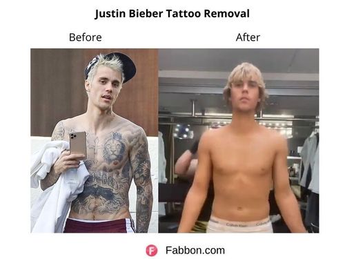 Justin Bieber removing the final Selena Gomez tattoo after 5 years of  marriage to Hailey Bieber  YouTube