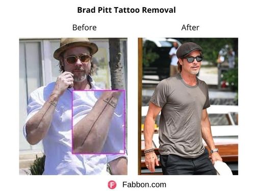 Brad-Pitt-Tattoo-Removal 