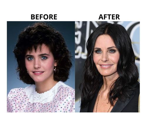 courteney-cox-before-after-plastic-surgery