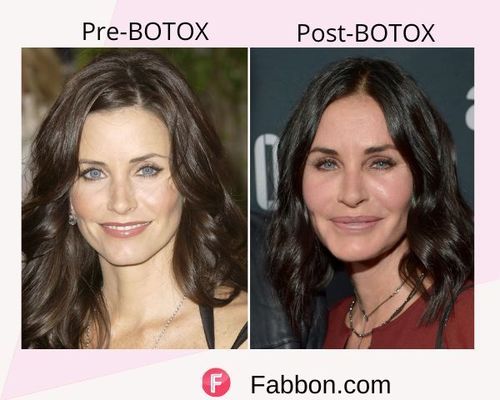 courtney cox Before and after BOTOX