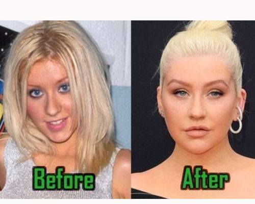 Christina Aguilera Plastic Surgery Secrets Know Everything Fabbon