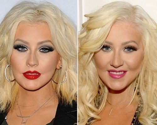 christina-aguilera-plastic-surgery-cheek-fillers