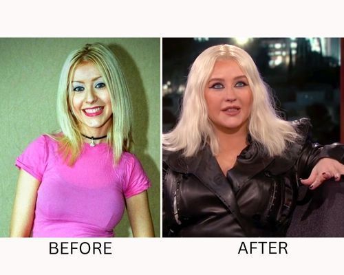 Christina Aguilera Plastic Surgery Secrets Know Everything Fabbon