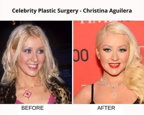 christina-aguilera-plastic-surgery