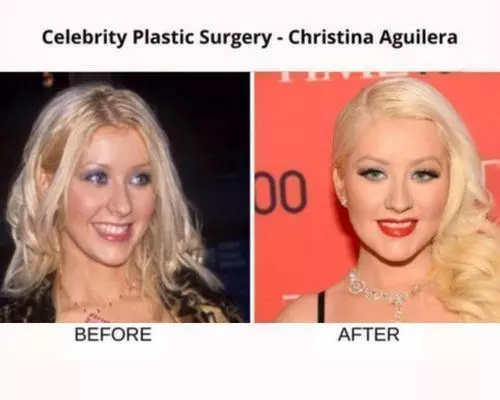 Celebrity-plastic-surgery-christina-aguilera