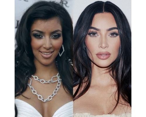 Kim kardashian Before after
