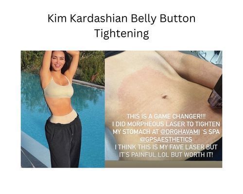 kim-kardashian-belly-tightening