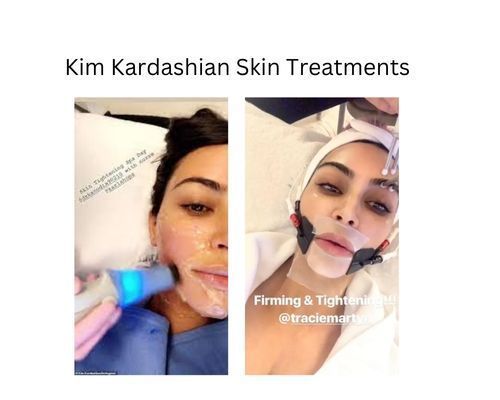 kim-kardashian-skin-treatments