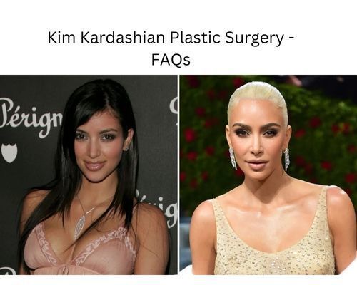 kim-kardashian-plastic-surgery-faqs