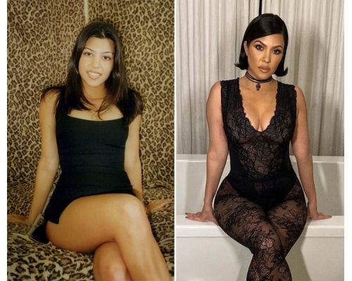 kourtney breast augmentation