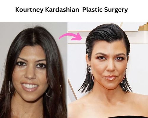 kourtney kardashian nose job before and after