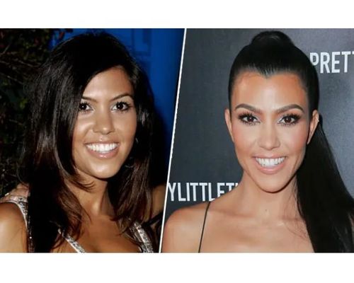 9 Plastic Surgeries Explain Kourtney Kardashian's Transformation | Fabbon