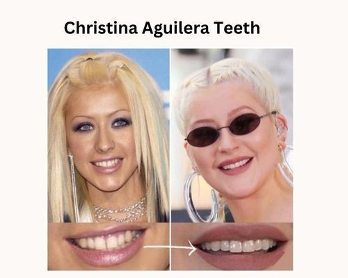 christina-aquilera-teeth (1)
