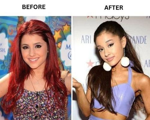 ariana-grande-plastic-surgery-before-after