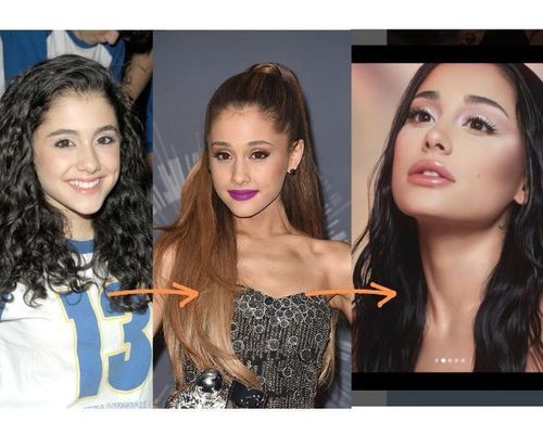 Ariana Grande Plastic Surgery - All Details Revealed! | Fabbon