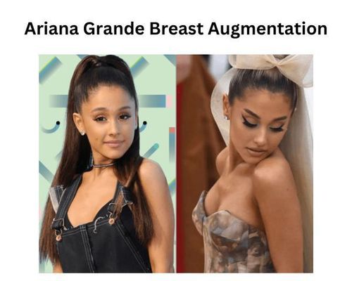 ariana-grande-breast-augmentation