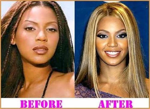 Beyonce-nose-job-before-and-after