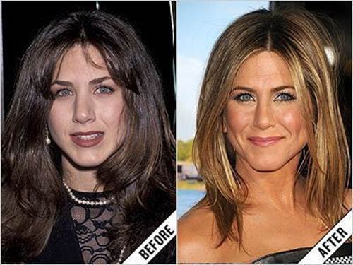 Jennifer-Aniston-nose-job-before-and-after