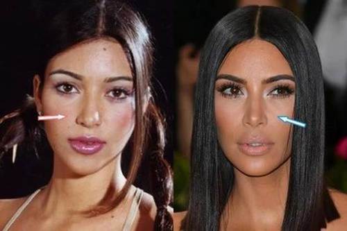 Kim-Kardashian-nose-job-before-and-after