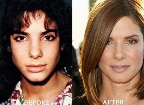 Sandra-Bullock-nose-job-before-and-after
