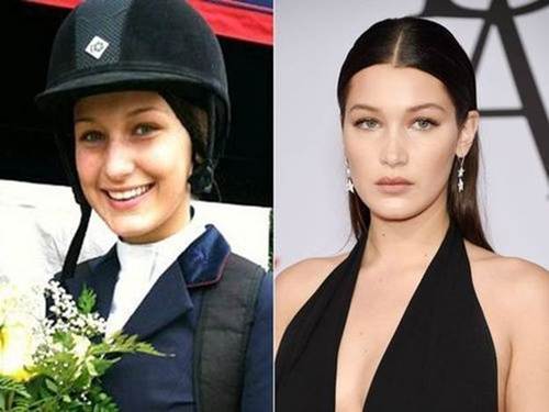bella-Hadid-nose-job-before-and-after