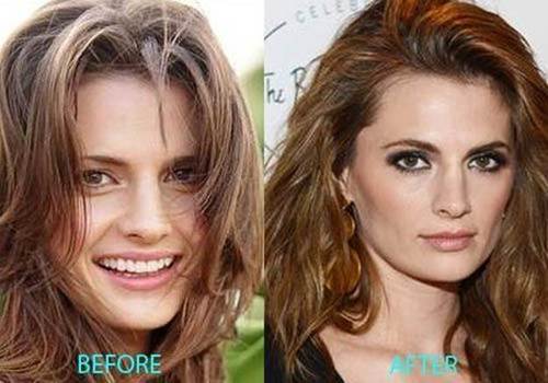 Stana-Katic-nose-job-before-and-after