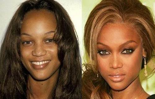 Tyra-Banks-nose-job-before-and-after
