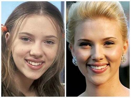 Scarlett-Johansson-nose-job-before-and-after