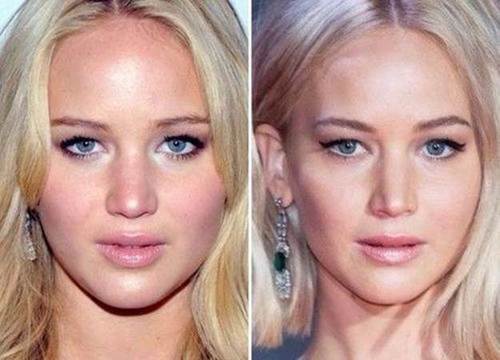 Jennifer-Lawrence-nose-job-before-and-after