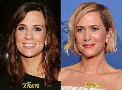 Kristen-Wiig-nose-job-before-and-after