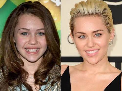 Miley-Cyrus-nose-job-before-and-after