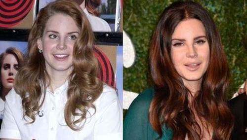 lana-del-Rey-nose-job-before-and-after