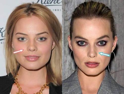 Margot-Robbie-nose-job-before-and-after