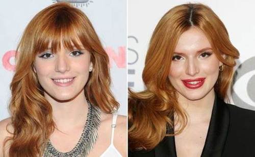 Bella-Thorne-nose-job-before-and-after