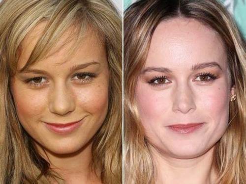 Brie-Larson-nose-job-before-and-after