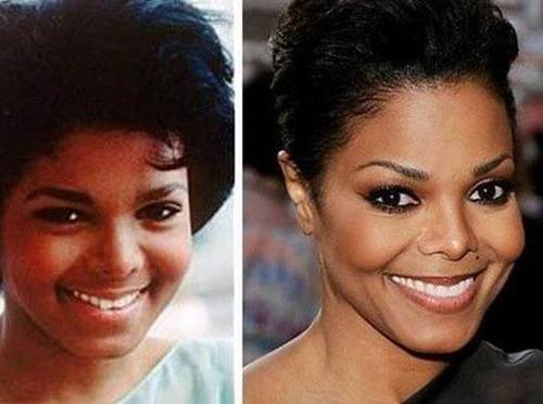 Janet-Jackson-nose-job-before-and-after