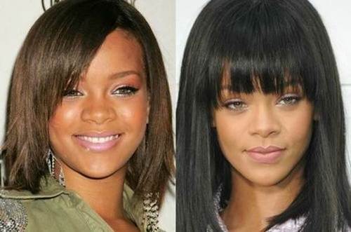Rihanna-nose-job-before-and-after