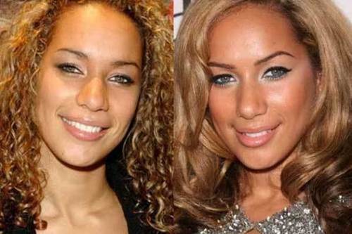 Leona-Lewis-nose-job-before-and-after