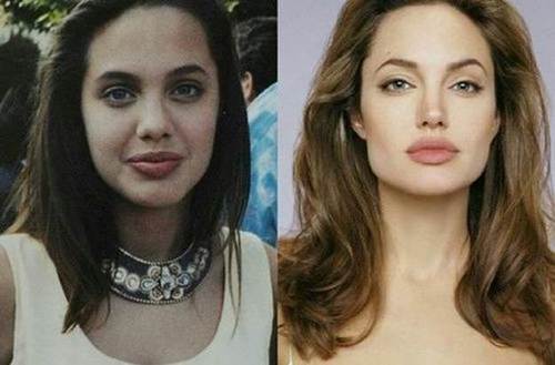 Angelina-jolie-nose-job-before-and-after